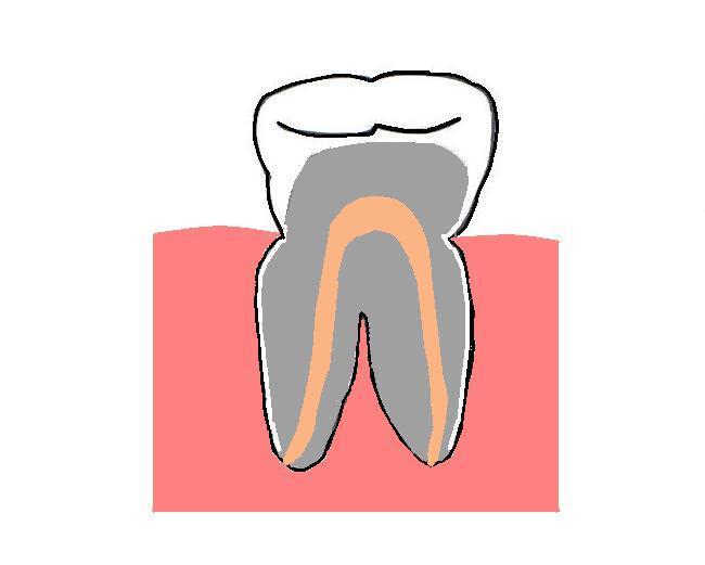 tooth model